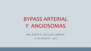 MR2 DARIO N. AGUILAR CABRERA.
17 DE AGOSTO - 2022
BYPASS ARTERIAL
Y ANGIOSOMAS
 