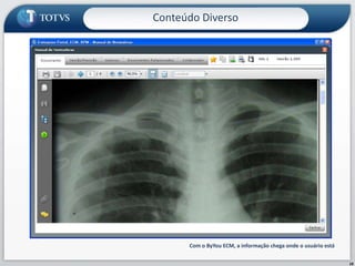 18Com o ByYou ECM, a informação chega onde o usuário estáConteúdo Diverso