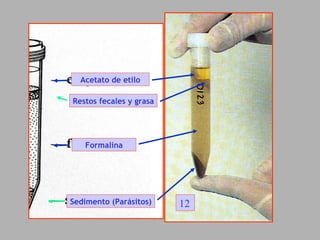 Restos fecales y grasa Acetato de etilo Formalina Sedimento (Parásitos) 12 