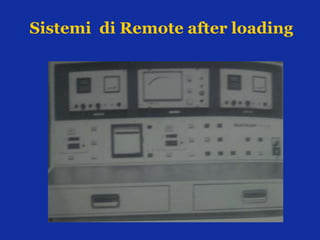 Sistemi di Remote after loading
 