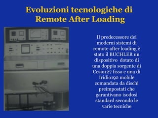 Evoluzioni tecnologiche di
Remote After Loading
Il predecessore dei
moderni sistemi di
remote after loading è
stato il BUCHLER un
dispositivo dotato di
una doppia sorgente di
Cesio127 fissa e una di
Iridio192 mobile
comandata da dischi
preimpostati che
garantivano isodosi
standard secondo le
varie tecniche
 