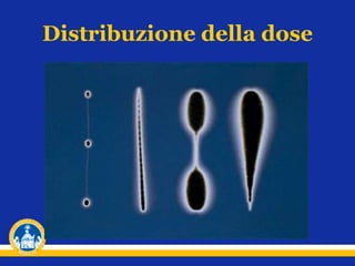 Distribuzione della dose
 