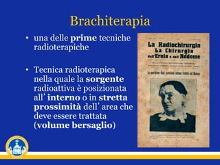 Brachiterapia
• una delle prime tecniche
radioterapiche
• Tecnica radioterapica
nella quale la sorgente
radioattiva è posizionata
all’interno o in stretta
prossimità dell’area che
deve essere trattata
(volume bersaglio)
 