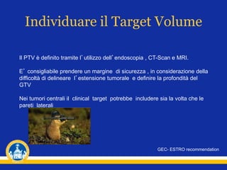 Individuare il Target Volume
Il PTV è definito tramite l’utilizzo dell’endoscopia , CT-Scan e MRI.
E’ consigliabile prendere un margine di sicurezza , in considerazione della
difficoltà di delineare l’estensione tumorale e definire la profondità del
GTV
Nei tumori centrali il clinical target potrebbe includere sia la volta che le
pareti laterali
GEC- ESTRO recommendation
 