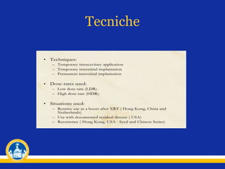 Tecniche
 