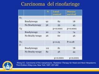 Carcinoma del rinofaringe
N Local
control
Disease
survival
T1
Brachyterapy 92 82 78
No Brachyterapy 56 53 43
T3 p=0.0001 p=0.0001
Brachyterapy 20 74 74
No Brachy terapy 26 60 46
T1-
3
p=0.25 P=0.08
Brachyterapy 112 81 78
No Brachy terapy 82 56 44
p=0.0001 p=0.0001
Wang CC. Carcinoma of the nasopharynx. Radiation Therapy for Head and Neck Neoplasms.
Third Edition.Wiley-Liss, New York 1997; 257-260
 