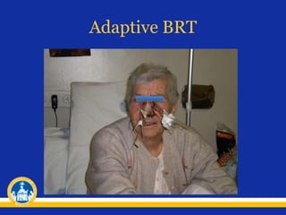 Adaptive BRT
 