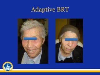 Adaptive BRT
 