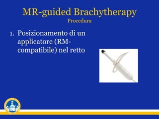 MR-guided Brachytherapy
Procedura
1. Posizionamento di un
applicatore (RM-
compatibile) nel retto
 