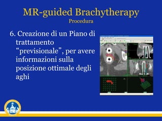 6. Creazione di un Piano di
trattamento
“previsionale”, per avere
informazioni sulla
posizione ottimale degli
aghi
MR-guided Brachytherapy
Procedura
 