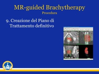 9. Creazione del Piano di
Trattamento definitivo
MR-guided Brachytherapy
Procedura
 
