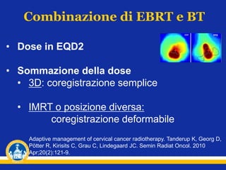 Combinazione di EBRT e BT
• Dose in EQD2
• Sommazione della dose
• 3D: coregistrazione semplice
• IMRT o posizione diversa:
coregistrazione deformabile
Adaptive management of cervical cancer radiotherapy. Tanderup K, Georg D,
Pötter R, Kirisits C, Grau C, Lindegaard JC. Semin Radiat Oncol. 2010
Apr;20(2):121-9.
 