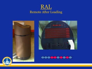 RAL
Remote After Loading
 