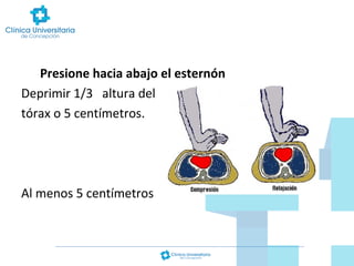Presione hacia abajo el esternón
Deprimir 1/3 altura del
tórax o 5 centímetros.

Al menos 5 centímetros

 