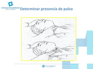 Determinar presencia de pulso

 