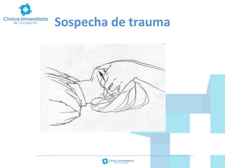 Sospecha de trauma

 