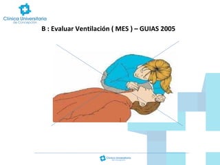 B : Evaluar Ventilación ( MES ) – GUIAS 2005

 