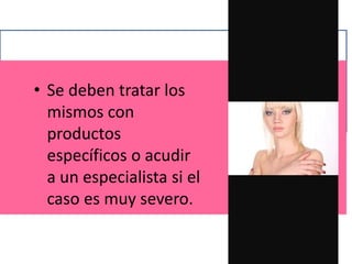 • Se deben tratar los
mismos con
productos
específicos o acudir
a un especialista si el
caso es muy severo.
 