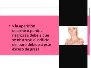 • y la aparición
de acné o puntos
negros se debe a que
se obstruye el orificio
del poro debido a este
exceso de grasa.
 