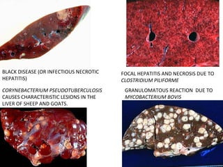 FOCAL HEPATITIS AND NECROSIS DUE TO
CLOSTRIDIUM PILIFORME
CORYNEBACTERIUM PSEUDOTUBERCULOSIS
CAUSES CHARACTERISTIC LESIONS IN THE
LIVER OF SHEEP AND GOATS.
GRANULOMATOUS REACTION DUE TO
MYCOBACTERIUM BOVIS
BLACK DISEASE (OR INFECTIOUS NECROTIC
HEPATITIS)
 