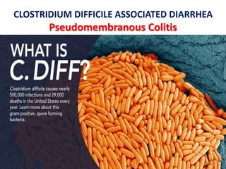 Clostridium difficile by Dr.T.V.Rao MD | PPTX