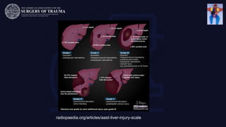 radiopaedia.org/articles/aast-liver-injury-scale
 
