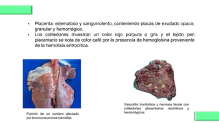 Vasculitis trombótica y necrosis tisular con
cotiledones placentarios necróticos y
hemorrágicos
Pulmón de un cordero afectado
por bronconeumonia clamidial.
• Placenta: edematoso y sanguinolento, conteniendo placas de exudado opaco,
granular y hemorrágico.
• Los cotiledones muestran un color rojo púrpura o gris y el tejido peri
placentario se nota de color café por la presencia de hemoglobina proveniente
de la hemolisis eritrocítica.
 