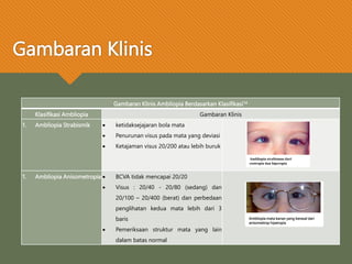 Gambaran Klinis Ambliopia Berdasarkan Klasifikasi14
Klasifikasi Ambliopia Gambaran Klinis
1. Ambliopia Strabismik  ketidaksejajaran bola mata
 Penurunan visus pada mata yang deviasi
 Ketajaman visus 20/200 atau lebih buruk
1. Ambliopia Anisometropia  BCVA tidak mencapai 20/20
 Visus : 20/40 - 20/80 (sedang) dan
20/100 – 20/400 (berat) dan perbedaan
penglihatan kedua mata lebih dari 3
baris
 Pemeriksaan struktur mata yang lain
dalam batas normal
Ambliopia strabismus dari
esotropia dan hiperopia
Ambliopia mata kanan yang berasal dari
anisometrop hiperopia
Gambaran Klinis
 
