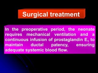 Surgical treatment
In the preoperative period, the neonate
requires mechanical ventilation and a
continuous infusion of prostaglandin E1 to
maintain ductal patency, ensuring
adequate systemic blood flow.
 