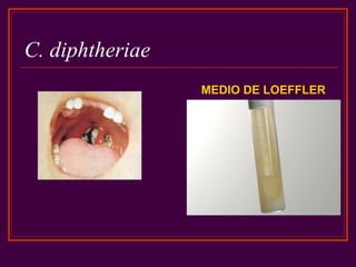 C. diphtheriae
MEDIO DE LOEFFLER
 