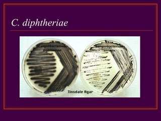 C. diphtheriae
 
