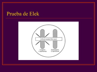 Prueba de Elek
 