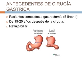ANTECEDENTES DE CIRUGÍA
GÁSTRICA




Pacientes sometidos a gastrectomía (Billroth I)
De 15-20 años después de la cirugía.
Reflujo biliar

 