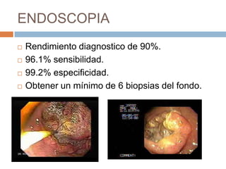 ENDOSCOPIA





Rendimiento diagnostico de 90%.
96.1% sensibilidad.
99.2% especificidad.
Obtener un mínimo de 6 biopsias del fondo.

 