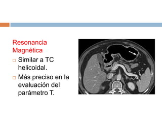 Resonancia
Magnética
 Similar a TC
helicoidal.
 Más preciso en la
evaluación del
parámetro T.

 