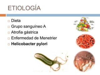 ETIOLOGÍA







Dieta
Grupo sanguíneo A
Atrofia gástrica
Enfermedad de Menetrier
Helicobacter pylori

 