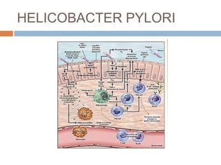 HELICOBACTER PYLORI

 