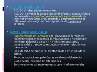  H.C. OFTALMOLOGÍA:
   F.O. OI: sin alteraciones relevantes.
   F.O. OD: a nivel de la arcada temporal inferior y extendiéndose
      por fuera de esta, lesión coroidea endofítica pigmentada de
      unos 5 diámetros papilares, asociada a desprendimiento de
      retina exudativo regional que impresiona de melanoma
      coroideo.

 RMN CRANEAL/ÓRBITA:
   Engrosamiento de la coroides del globo ocular derecho de
      hiperintensidad en secuencia T1 y que asienta a nivel basal y
      hemilateral derecho de 14 x 3 x 7 mm anteroposterior,
      craneocaudal y transverso respectivamente en relación con
      melanoma.
     Sin extensión extraocular ni afectación de estructuras de la
      orbita.
     Sin otras captaciones patológicas en el resto del estudio.
     Globo ocular izquierdo sin alteraciones.
     Sin alteraciones parenquimatosas supra ni infratentoriales.
 