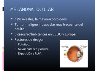 MELANOMA OCULAR
 95% uveales, la mayoría coroideos.
 Tumor maligno intraocular más frecuente del
  adulto.
 6 casos/106 habitantes en EEUU y Europa.
 Factores de riesgo:
   Fototipo.
   Nevus cutáneo y ocular.
   Exposición a RUV.
 