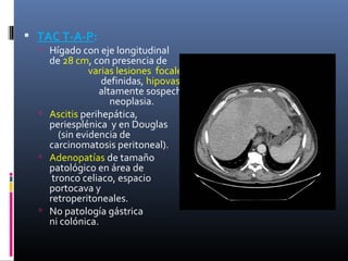  TAC T-A-P:
   Hígado con eje longitudinal
    de 28 cm, con presencia de
               varias lesiones focales mal
                  definidas, hipovasculares,
                 altamente sospechosas de
                    neoplasia.
   Ascitis perihepática,
    periesplénica y en Douglas
       (sin evidencia de
    carcinomatosis peritoneal).
   Adenopatías de tamaño
    patológico en área de
     tronco celiaco, espacio
    portocava y
    retroperitoneales.
   No patología gástrica
    ni colónica.
 