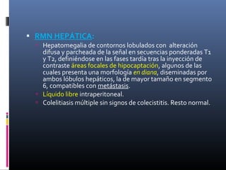  RMN HEPÁTICA:
   Hepatomegalia de contornos lobulados con alteración
    difusa y parcheada de la señal en secuencias ponderadas T1
    y T2, definiéndose en las fases tardía tras la inyección de
    contraste áreas focales de hipocaptación, algunos de las
    cuales presenta una morfología en diana, diseminadas por
    ambos lóbulos hepáticos, la de mayor tamaño en segmento
    6, compatibles con metástasis.
   Líquido libre intraperitoneal.
   Colelitiasis múltiple sin signos de colecistitis. Resto normal.
 