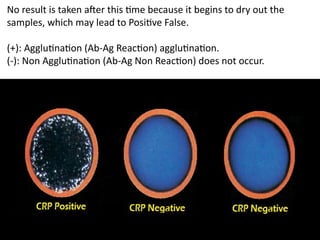 No result is taken after this time because it begins to dry out the
samples, which may lead to Positive False.
(+): Agglutination (Ab-Ag Reaction) agglutination.
(-): Non Agglutination (Ab-Ag Non Reaction) does not occur.
 