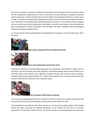 The cow is controlled in standing or right lateral recumbency and al long skin incision is given by saving
the left subcutaneous abdominal vein. We can either give the local infiltration or epidural anesthesia
with 2% Lignocaine. In bitch, the bifurcation of uterine body is first visualized and incision is made over it
in order to enable the milking of pups (squeezing the pups out from the horns) from both the horns is
easy. The fetuses are removed along with fetal membrane one by one. The umbilical vessels are ligated
and cut and the new born are handed over o the helper or nurse for resuscitation. They are wiped with
mops and assisted for artificial respiration if fail to breathe. The head is lowered to permit drainage of
fluids from the upper respiratory tract.

In cow the uterine incision should follow the longitudinal line of greater curvature of the uterus. (Fig 2
and Fig 3)




                          Fig 2: Uterus is packed off from the abdominal cavity




                          Fig 3: Fetus being taken out from the uterus

Forelimbs or hind limbs are grasped depending upon the presentation and the fetus is taken out from
the uterus. The calf should be care by the assistants. It should be cleaned, dried, cleared off the mucus
from the nostrils. The umbilical cord is ligated far enough from the navel and cut so that it contracts.
Antiseptic solution like povidone iodine or Tr. Iodine is then applied over it to present the infective the
removal of after births or placenta is also important. (Fig 4)




                             Fig 4: Removal of after births or placenta

 If it is easily removed by gentle traction it should be removed or otherwise, it should not be pulled with
force since chances of caruncular bleeding is strong which may be fatal to the dam.

If such bleeding is encountered in the dam, then we can counteract it by giving oxytocin which largely
shrinks the uterus and stops the bleeding. Antibiotics can be instilled into the uterus as common
procedure for all the species before closure. The uterine incision is cleaned with gauze and closed by a
 