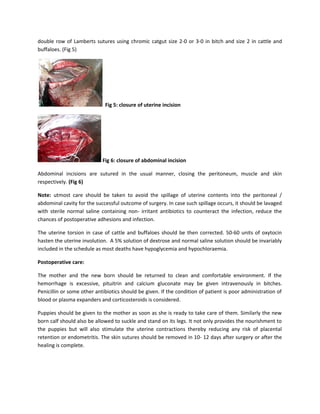 double row of Lamberts sutures using chromic catgut size 2-0 or 3-0 in bitch and size 2 in cattle and
buffaloes. (Fig 5)




                             Fig 5: closure of uterine incision




                            Fig 6: closure of abdominal incision

Abdominal incisions are sutured in the usual manner, closing the peritoneum, muscle and skin
respectively. (Fig 6)

Note: utmost care should be taken to avoid the spillage of uterine contents into the peritoneal /
abdominal cavity for the successful outcome of surgery. In case such spillage occurs, it should be lavaged
with sterile normal saline containing non- irritant antibiotics to counteract the infection, reduce the
chances of postoperative adhesions and infection.

The uterine torsion in case of cattle and buffaloes should be then corrected. 50-60 units of oxytocin
hasten the uterine involution. A 5% solution of dextrose and normal saline solution should be invariably
included in the schedule as most deaths have hypoglycemia and hypochloraemia.

Postoperative care:

The mother and the new born should be returned to clean and comfortable environment. If the
hemorrhage is excessive, pituitrin and calcium gluconate may be given intravenously in bitches.
Penicillin or some other antibiotics should be given. If the condition of patient is poor administration of
blood or plasma expanders and corticosteroids is considered.

Puppies should be given to the mother as soon as she is ready to take care of them. Similarly the new
born calf should also be allowed to suckle and stand on its legs. It not only provides the nourishment to
the puppies but will also stimulate the uterine contractions thereby reducing any risk of placental
retention or endometritis. The skin sutures should be removed in 10- 12 days after surgery or after the
healing is complete.
 