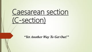 Caesarean section
(C-section)
“Yet Another Way To Get Out!”
 