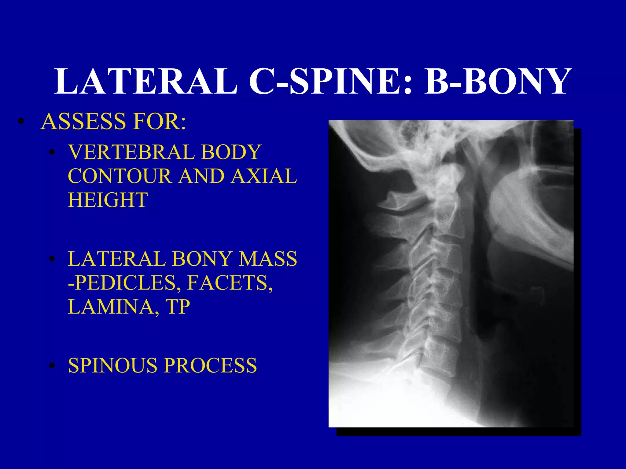 Bonye Process Cervical Spine Injury | C Spine | Clearing the Cervical Spine | PPT