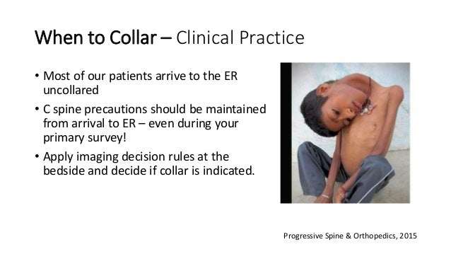 Cervical Spine Clearance In Trauma For Moderate Resource Settings