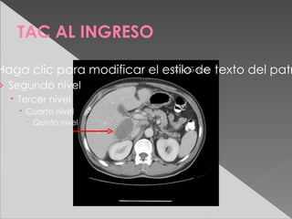 TAC AL INGRESO

Haga clic para modificar el estilo de texto del patr
                              63x35 mm

› Segundo nivel
   Tercer nivel
    Cuarto nivel
      Quinto nivel
 