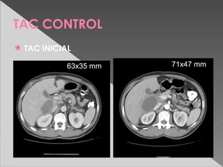 TAC CONTROL
   TAC INICIAL

              63x35 mm                71x47 mm




                         TAC A LAS 2 Sem.
 