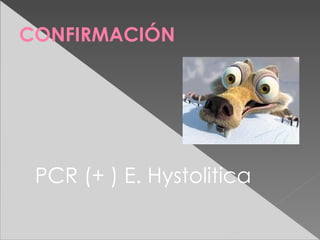 CONFIRMACIÓN




 PCR (+ ) E. Hystolitica
 